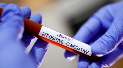 চট্টগ্রামে আরও ১৬০ জনের করোনা পজিটিভ, মারা গেছেন ২জন, সুস্থ ৫৯ জন