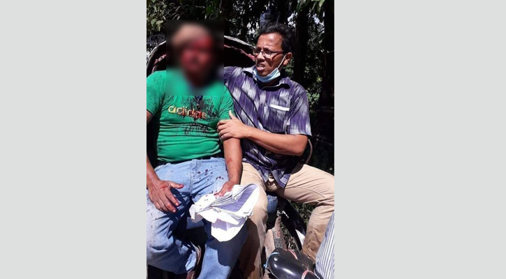 ম্যাজিস্ট্রেটের গাড়িতে ককটেল হামলা, চালক আহত