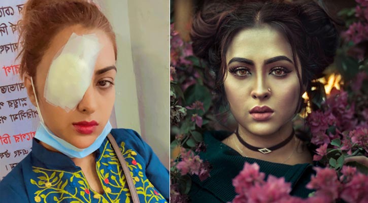 কন্টাক্ট লেন্স ব্যবহার করে চোখ নিয়ে বিপাকে তানহা