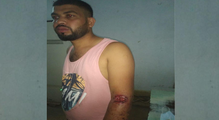 সাতকানিয়ায় ছিনতাইকারীর গুলিতে ব্যবসায়ী আহত