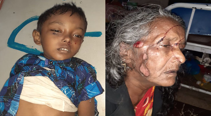 বাস-অটোরিকশা সংঘর্ষে নাতি নিহত, দাদি আহত