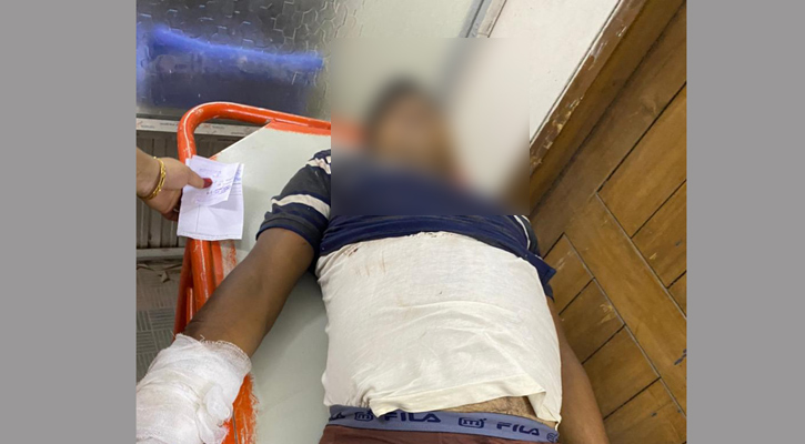 আনোয়ারায় টেম্পুর ধাক্কায় মোটরসাইকেল চালক নিহত