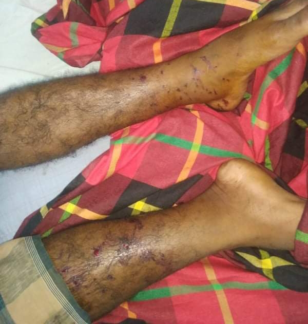 মীরসরাইয়ের খিলমুরালীতে ব্যবসায়ী গুলিবিদ্ধ 
