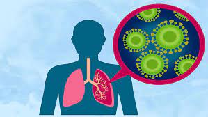 ১২ নভেম্বর বিশ্ব নিউমোনিয়া দিবস : ফুসফুস বা শ্বাসতন্ত্রের প্রদাহজনিত জটিল একটি রোগ নিউমোনিয়া