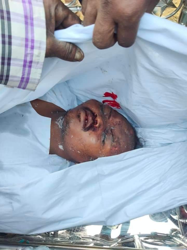  চকরিয়ায় গাছ কাটতে গিয়ে যুবক নিহত  