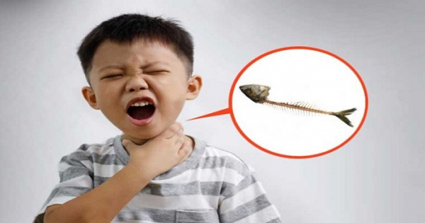 গলায় মাছের কাঁটা বিঁধলে যা করবেন!