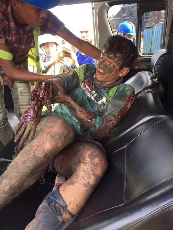 বাঁশখালীতে এস আলম পাওয়ার প্লান্টে হঠাৎ গ্যাস বিস্ফোরণ, গুরুতর আহত ১