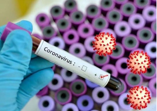 চট্টগ্রামে ৮ ল্যাবে ৪ করোনা রোগী শনাক্ত