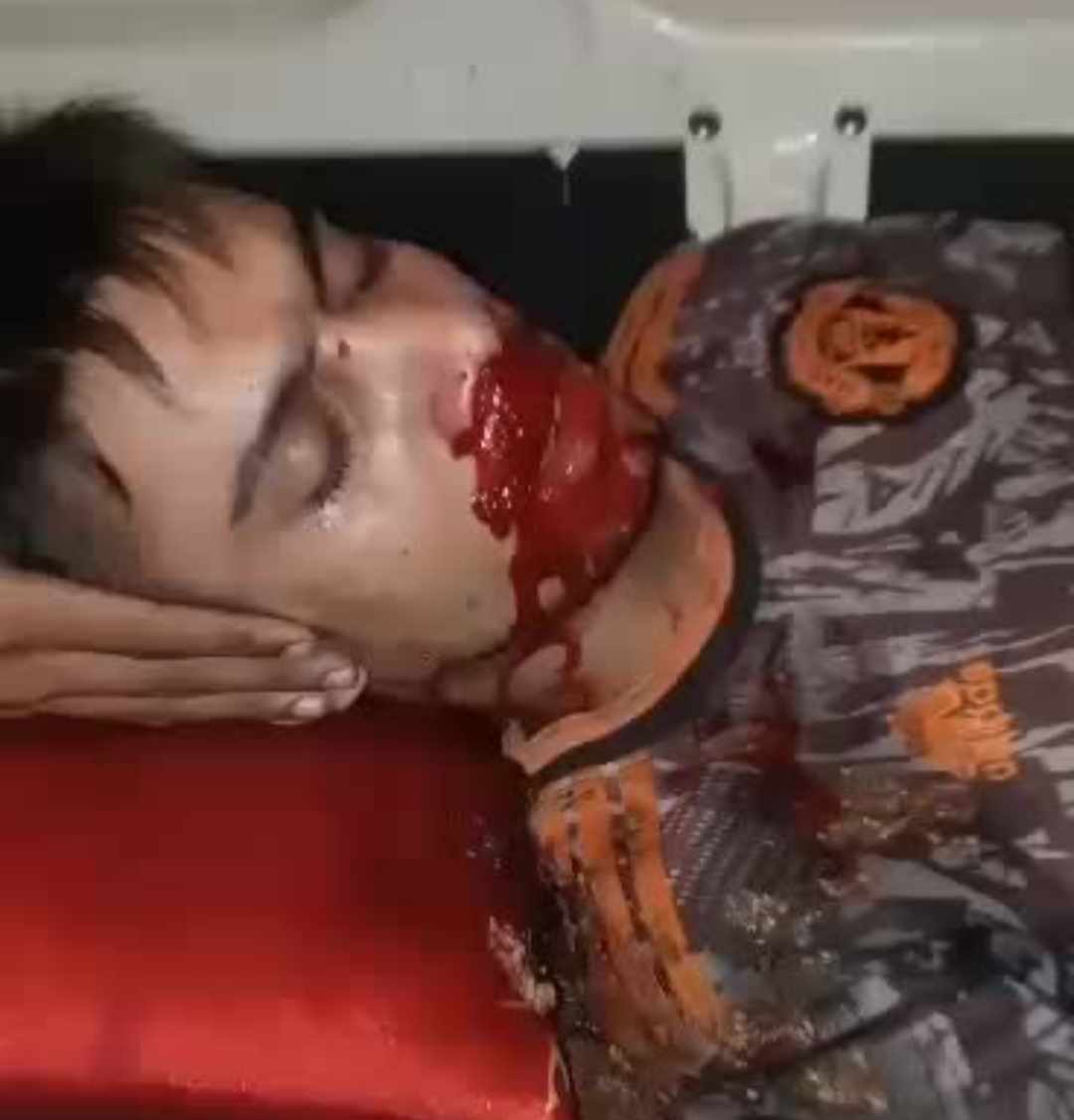 বাঘাইছড়ি পৌরসভার টোল আদায় নিয়ে বিএনপির দুই গ্রুপের সংঘর্ষ , আহত ৪