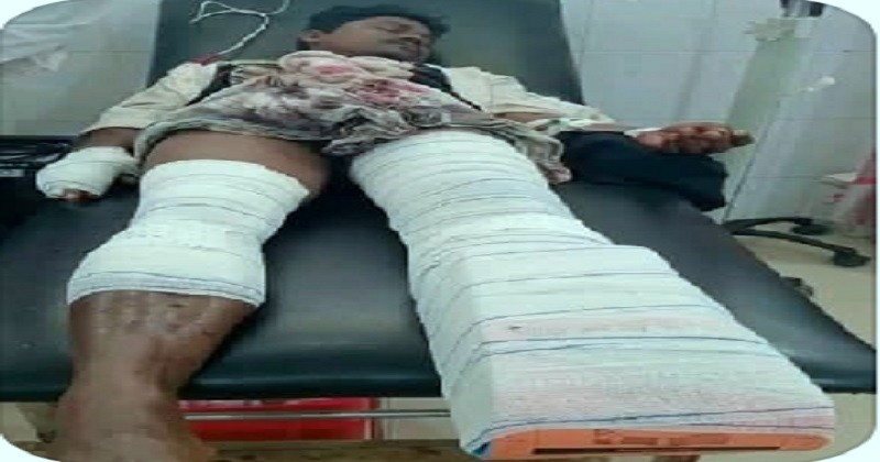 সীমান্তে পৃথক মাইন বিস্ফোরণে ১ জনের পা বিচ্ছিন্ন, আহত ৩