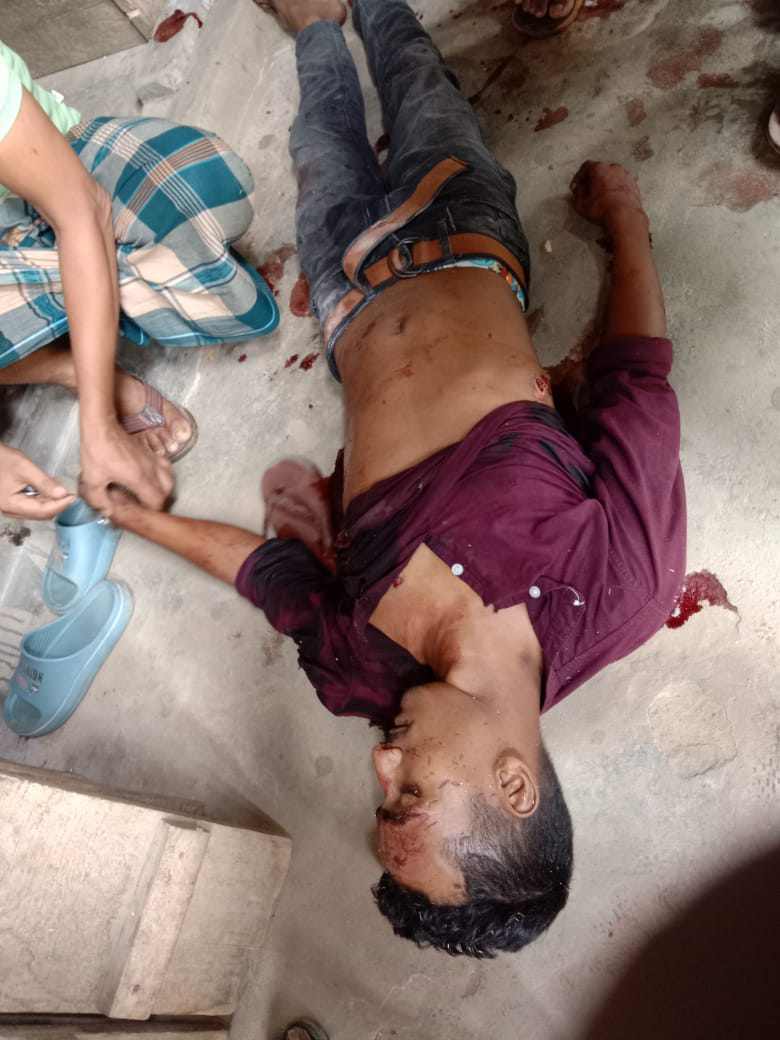 রাঙামাটিতে পাহাড়ি সন্ত্রাসীদের গুলিতে নিহত-১
