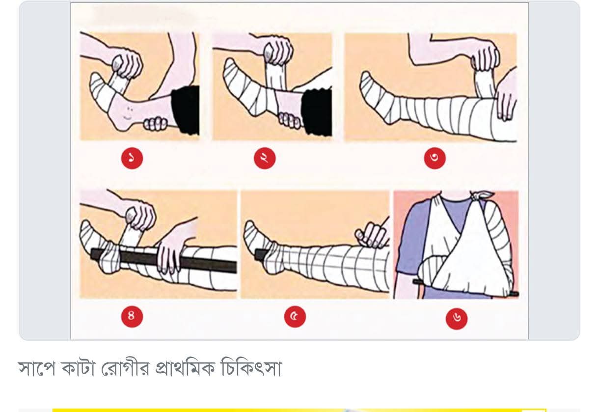 বোয়ালখালীতে ২৪ ঘন্টায় সাপে কাটা ৪ রোগী হাসপাতালে 