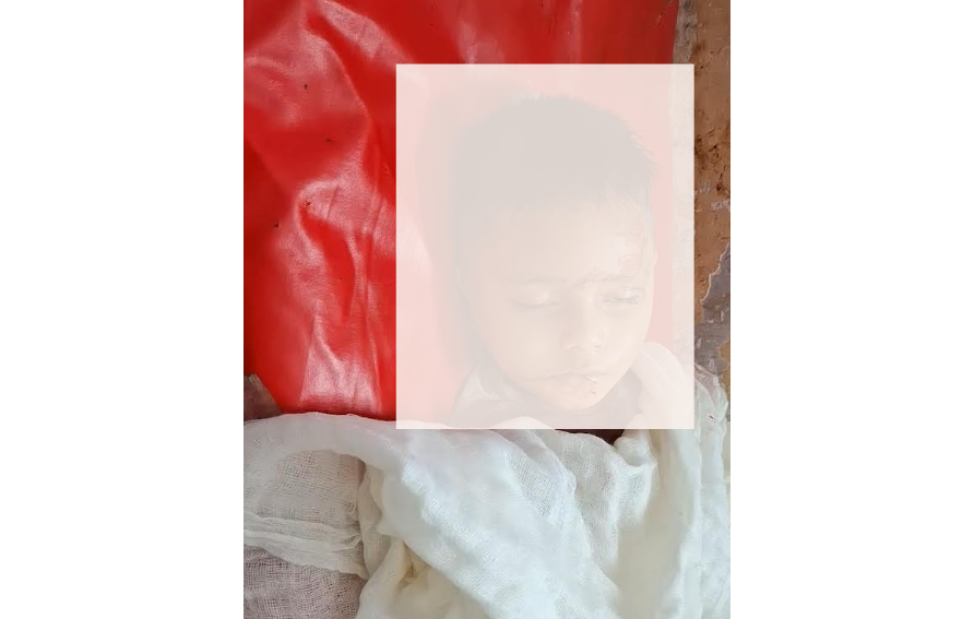 ফটিকছড়ি বেপরোয়া অটোরিকশার ধাক্কায় প্রাণ গেল তিন বছরের আনাছ