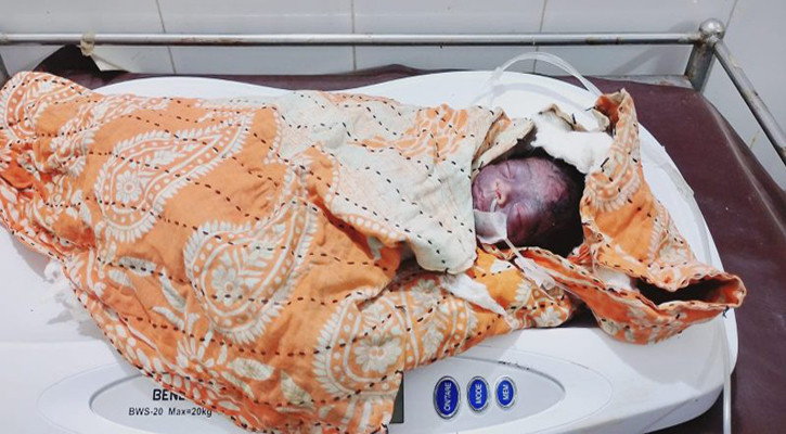 বাঁচানো গেলো না ছাইয়ের স্তূপে পাওয়া সেই নবজাতককে