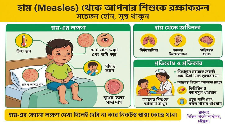 ২৪ ঘণ্টায় চট্টগ্রামে ৪ জনের হাম শনাক্ত