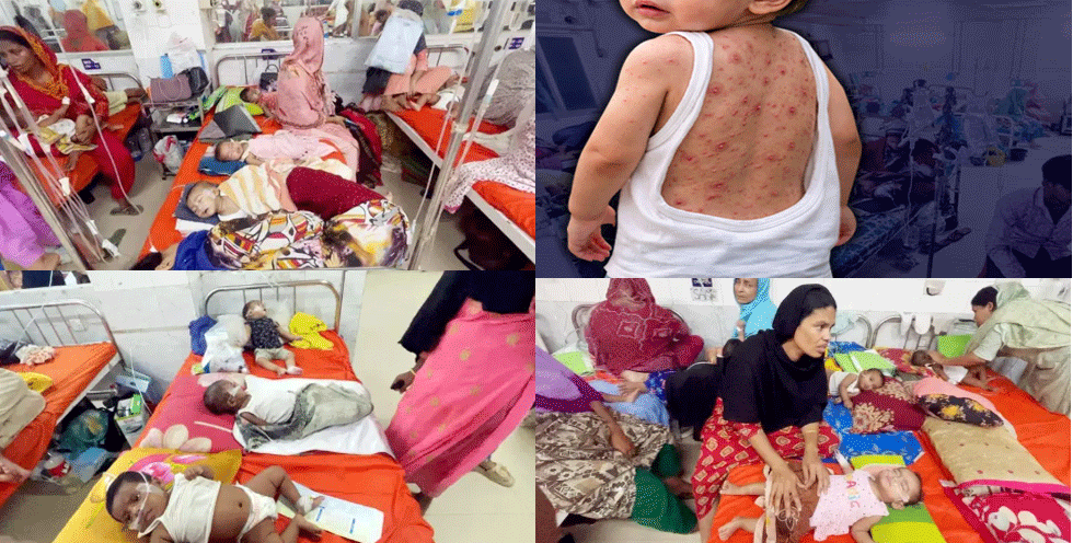 ঠান্ডা নাকি হাম, শিশুদের নিয়ে হাসপাতালে ছুটছেন বিভ্রান্ত অভিভাবকরা